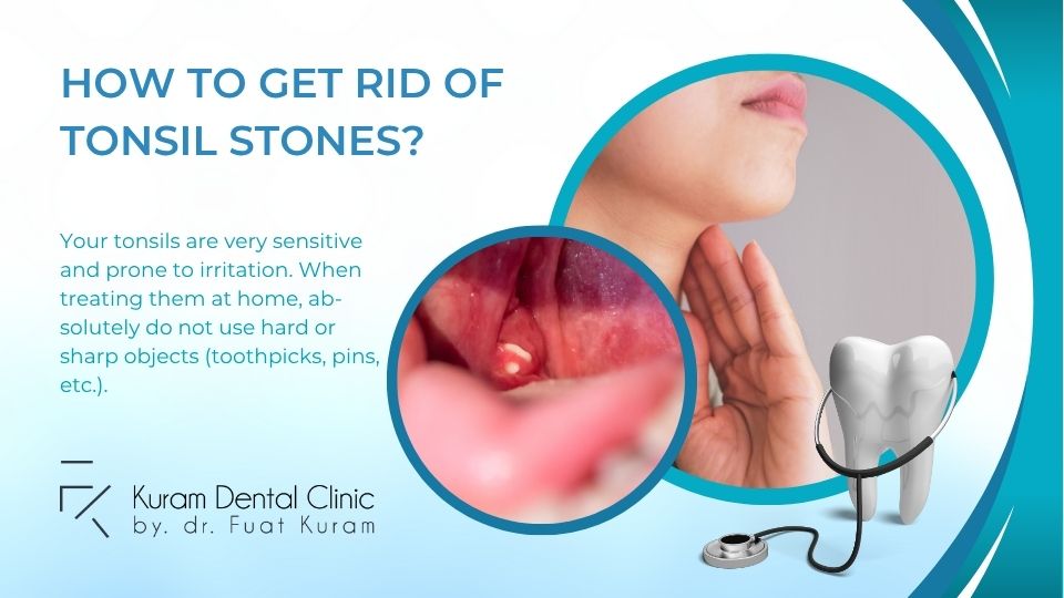 how to remove tonsil stones